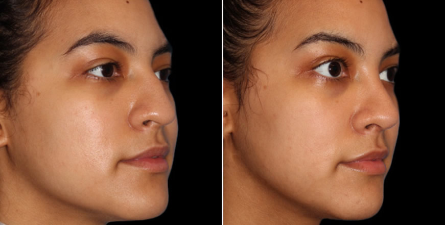 Plastic Surgery Results